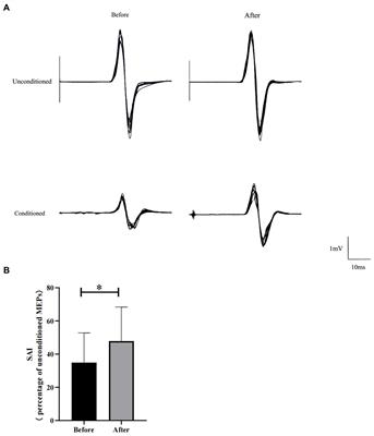 Neuromodulatory effects of high-definition theta transcranial alternating current stimulation on the parietal cortex: a pilot study of healthy males